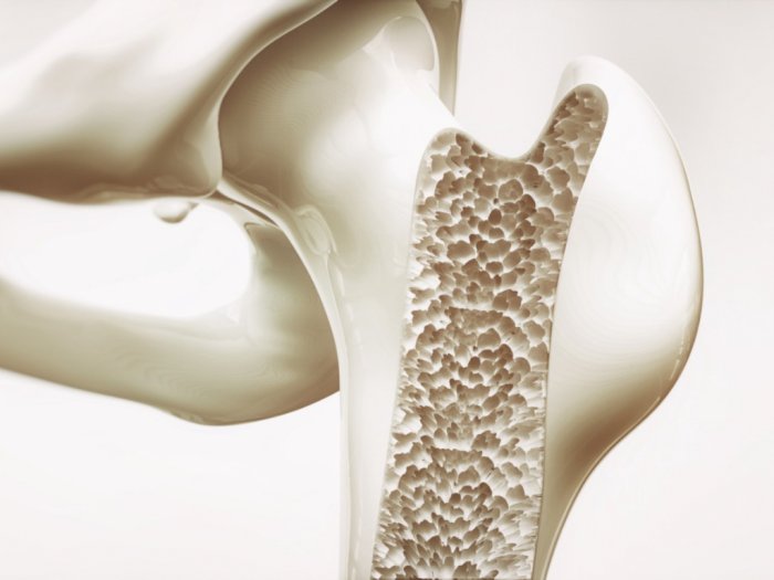 Ternyata Bahan Kimia Pada Sabun Bisa Tingkatkan Risiko Osteoporosis