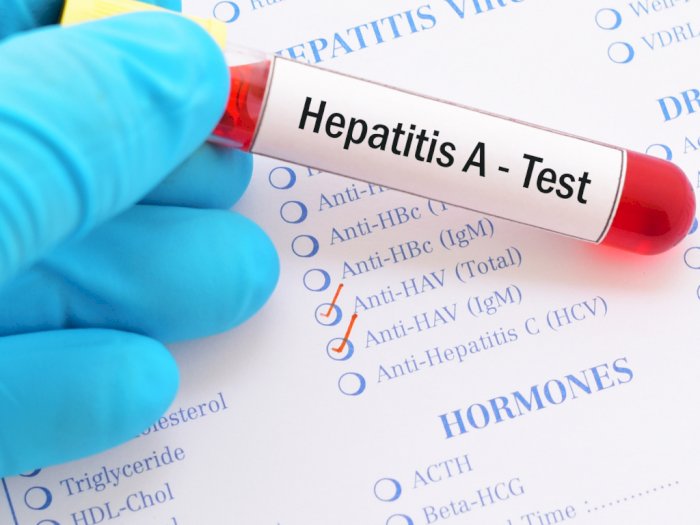 Apakah Penderita Hepatitis A Bisa Sembuh Total?