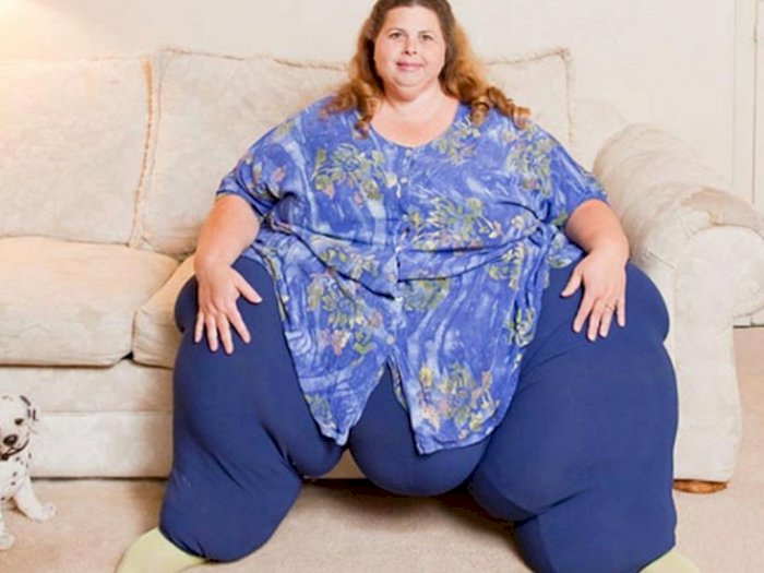 Berhasil Menurunkan Berat Badannya, Wanita Ini Malah Gemuk Lagi