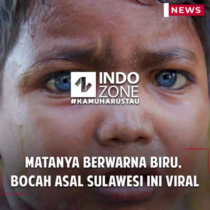 Matanya Berwarna Biru, Bocah Asal Sulawesi ini Viral