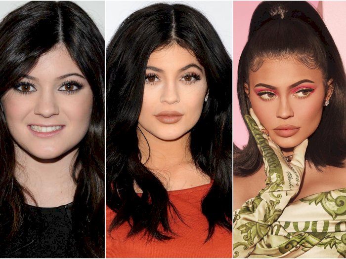 Berkali-kali Oplas, Beginilah Transformasi Wajah Kylie Jenner 