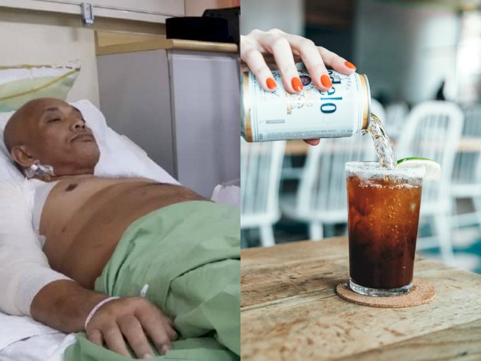 Karena Sering Minum Soda, Pria Ini Nyaris Kehilangan Lengannya