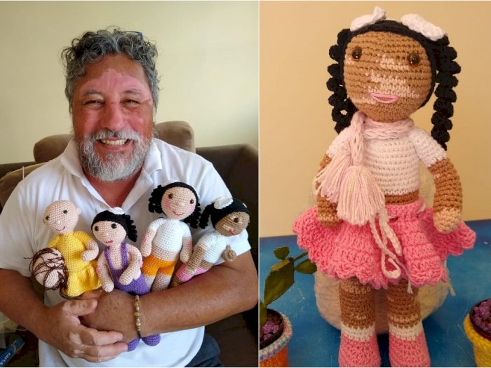 Bangkitkan Harga Diri Anak Vitiligo, Kakek Ini Rajut Boneka Vitilinda