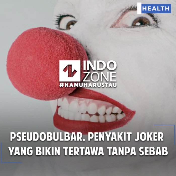 Pseudobulbar, Penyakit Joker  yang Bikin Tertawa Tanpa Sebab