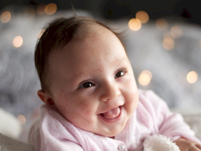 Bahayakah Muncul Bintik-Bintik Putih Pada Kulit  Bayi?