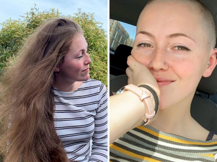 8 Transformasi Orang yang Donasikan Rambutnya untuk Penderita Kanker