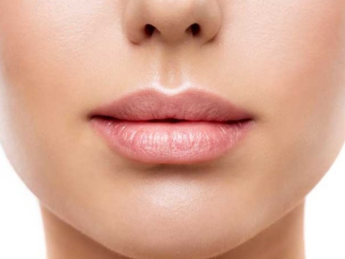 Mengenal Botox Lip Flip, Tren Bikin Bibir Lebih Berisi
