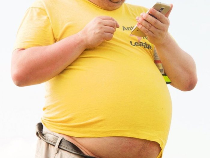Obesitas (Kegemukan) - Gejala, Penyebab, dan Penanganan