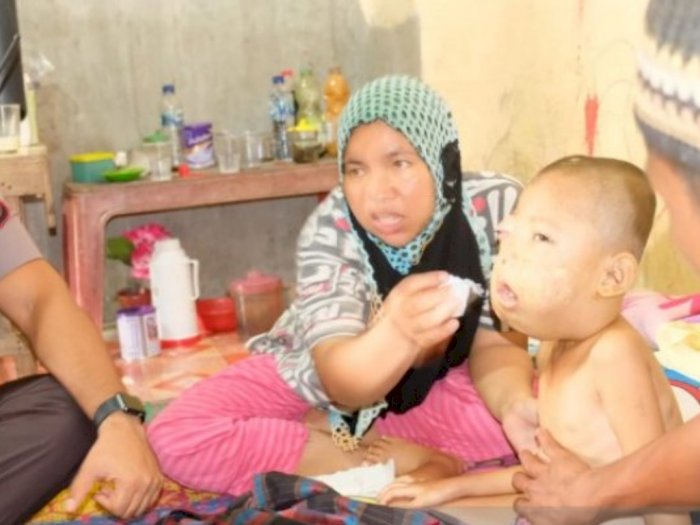Kapolres Tanjungbalai Bantu Anak Penderita Tumor Bernama Al Wahdy
