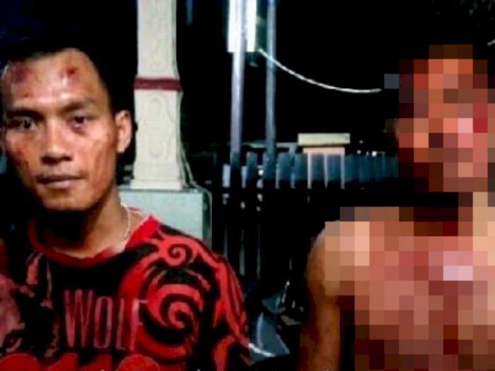 Dianiaya Preman Saat Jual Ayam di Pasar, TNI di Medan Terluka Parah