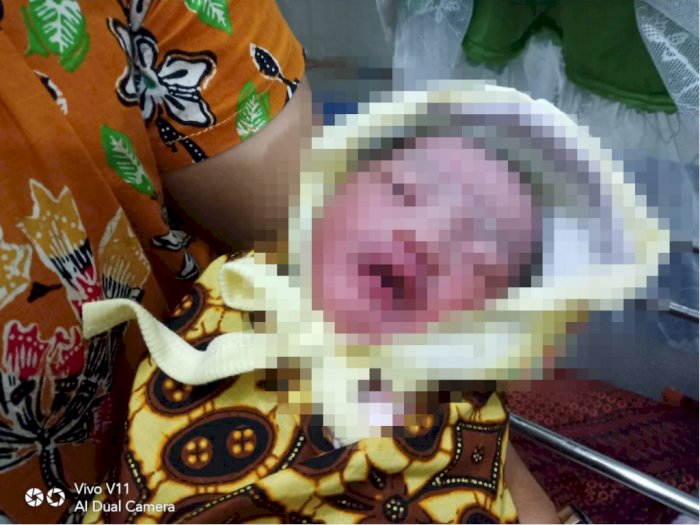 Kasihan, Bayi Ini Dibuang di Komplek PTPN II Tanjung Morawa