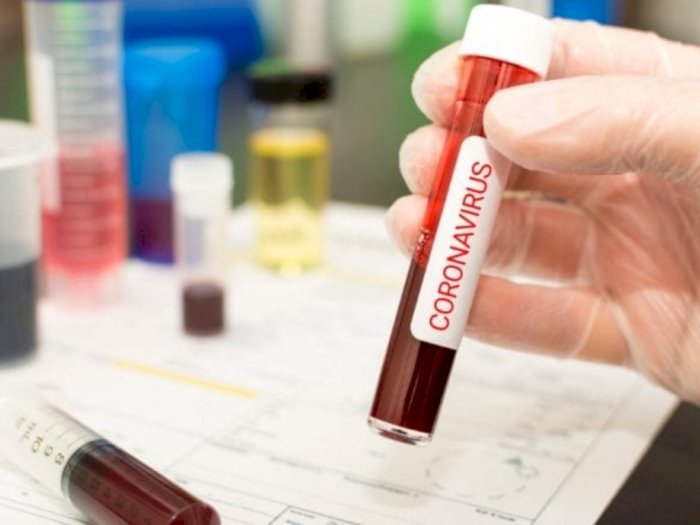 Benarkah Darah Pasien yang Sembuh Corona Bisa untuk Obati Orang Lain?