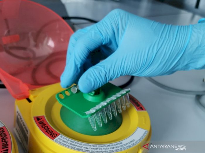 Kabar Baik! Prototipe Test Kit Virus Corona Buatan Indonesia Telah Rampung