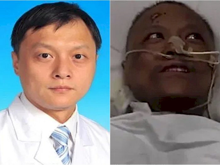 Warna Kulit 2 Dokter di Wuhan Menghitam Usai Terpapar Virus Corona dari Pasien