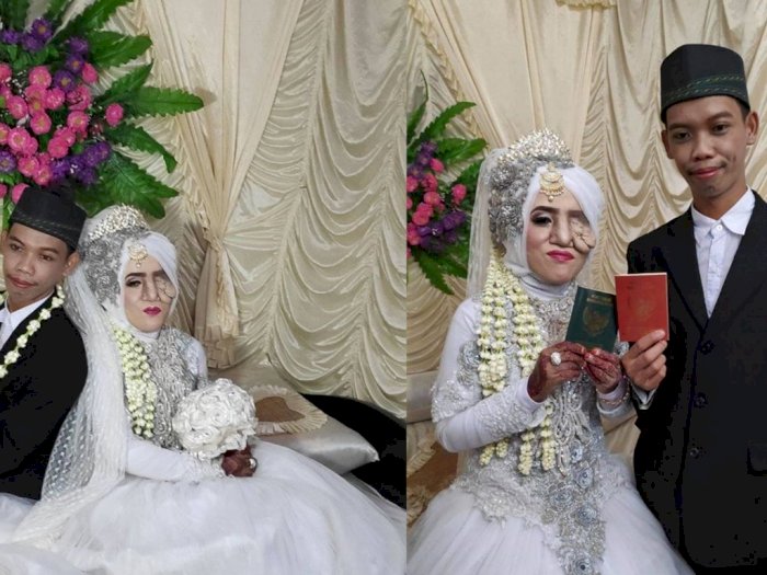 Nikahi Wanita Yang Memiliki Kelainan Wajah Pria Ini Buktikan Cinta Nggak Pandang Fisik Indozone Id Nikahi Wanita Yang Memiliki Kelainan Wajah Pria Ini Buktikan Cinta Nggak Pandang Fisik Indozone Id