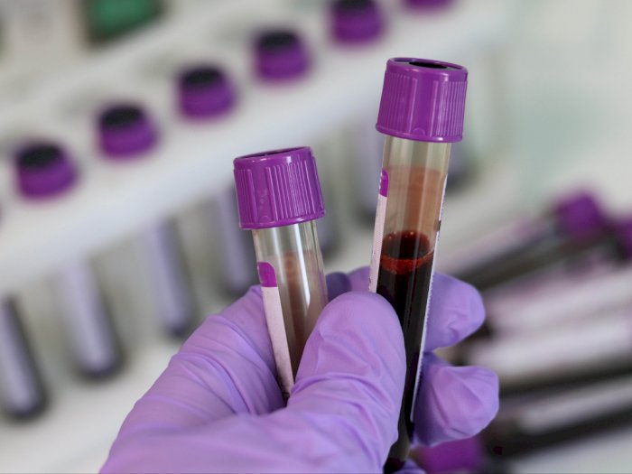 Plasma Darah Pasien Covid-19 yang Sembuh Dijual di Pasar Gelap Sebagai Vaksin