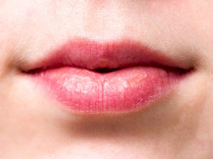 Bibir Biru Gejala Baru Virus Corona yang Harus Kita Waspadai
