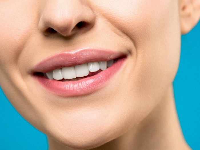 3 Aturan yang Harus Kamu Ingat Setelah Melakukan Perawatan Pemutihan Gigi