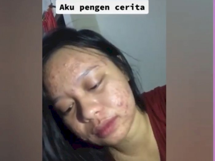 Seorang Wanita Curhat Ditinggal Gebetan Gegara si Cowok Jijik Lihat Wajahnya