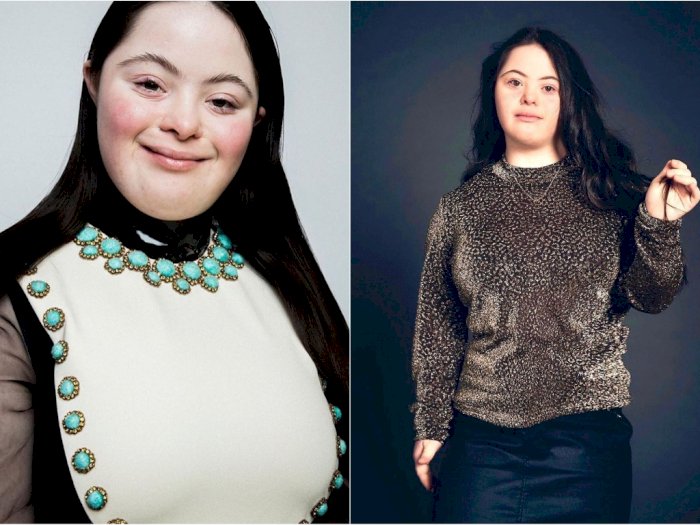 Ellie Goldstein, Remaja Down Syndrome yang Jadi Model Gucci Beauty