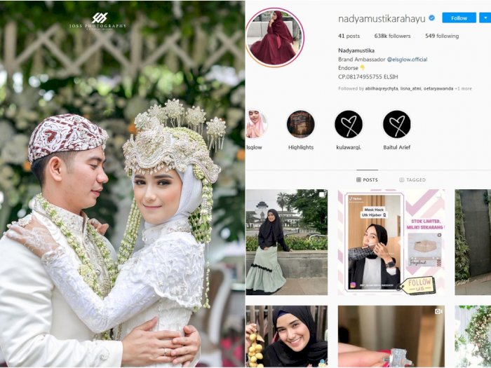 Balas Rizki DA, Nadya Mustika Rahayu Kini Ikut Ganti Foto Profil Tanpa Suami