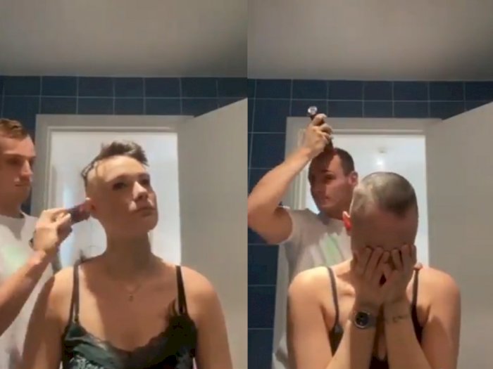 Pria ini Botakkan Rambut Untuk Dukung Kekasihnya yang Menderita Alopecia, Netizen Terharu