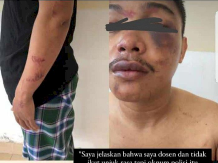Pakar Hukum Kecam Insiden Dosen Makassar Diduga Salah Tangkap dan Dipukuli Oknum Polisi