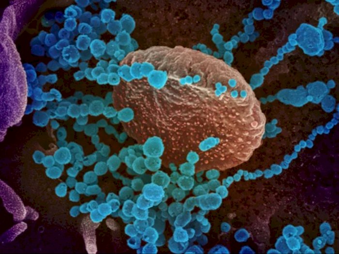 Muncul Virus Chapare Mematikan di Bolivia, Samakah Bahayanya dengan Covid-19?