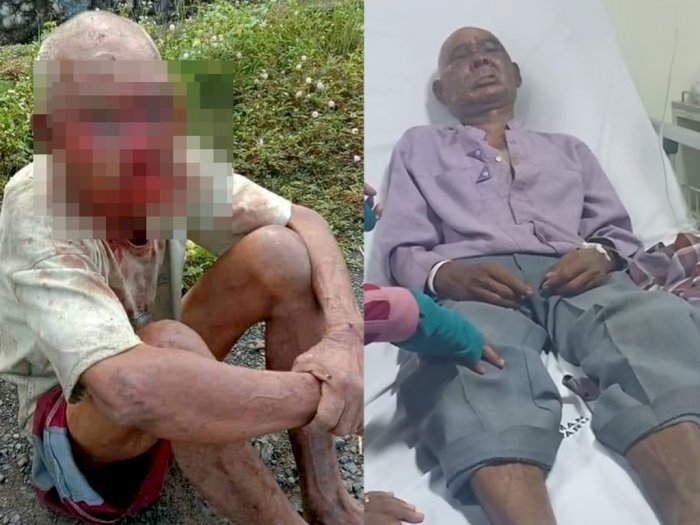 Viral Kakek Dipukuli dan Diseret ke Aspal karena Minta Rokok, Kondisinya Memprihatinkan