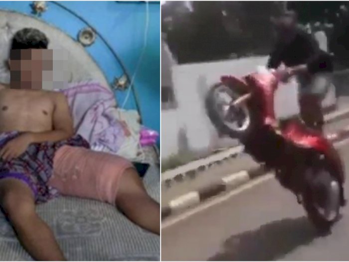 Sok Jago Standing Motor, Remaja SMP Berambut Pirang Terkapar, Tulang Kakinya Patah