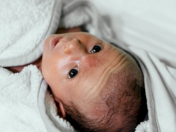 Ketahui Fakta Keringat pada Bayi yang Baru Lahir 