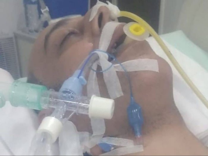 Mengejutkan Kondisi Syekh Ali Jaber Dirawat Intensif Dipasang Ventilator: Mohon Doanya