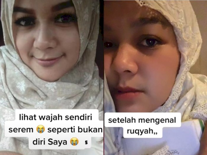 Viral Cewek Bagikan Penampakan Wajahnya Sebelum dan Sesudah Ruqyah, Netizen Pangling