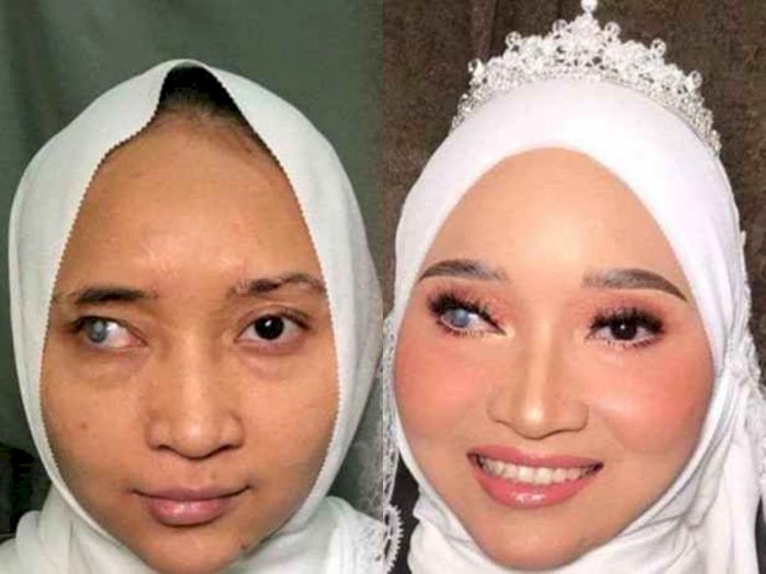 Power of Makeup! Wanita yang Punya Bekas Luka Ini Jadi Sangat Cantik Setelah Dirias