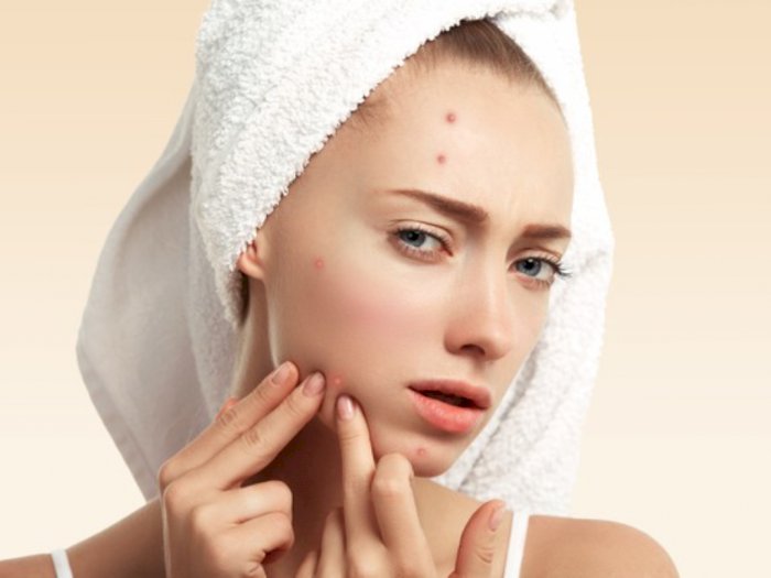 4 Bahan Aktif pada Skincare Ini Ampuh Atasi Bekas Jerawat