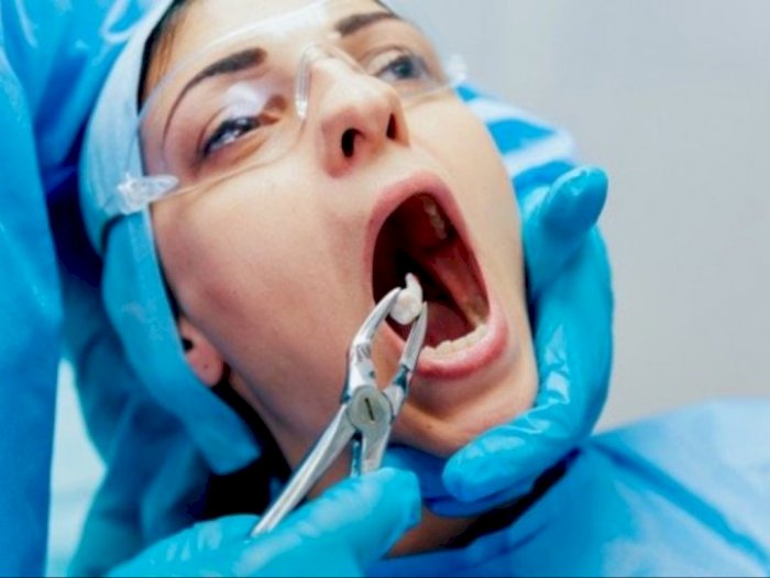 Cabut Gigi di Dokter Palsu Pria Ini Alami Patah Tulang Rahang, Penampakannya Bikin Ngilu
