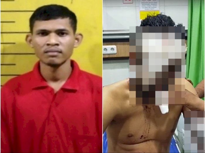 Fakta Pemuda Siram Air Keras di Medan, Cemburu Pujaan Hatinya Pacaran dengan Korban