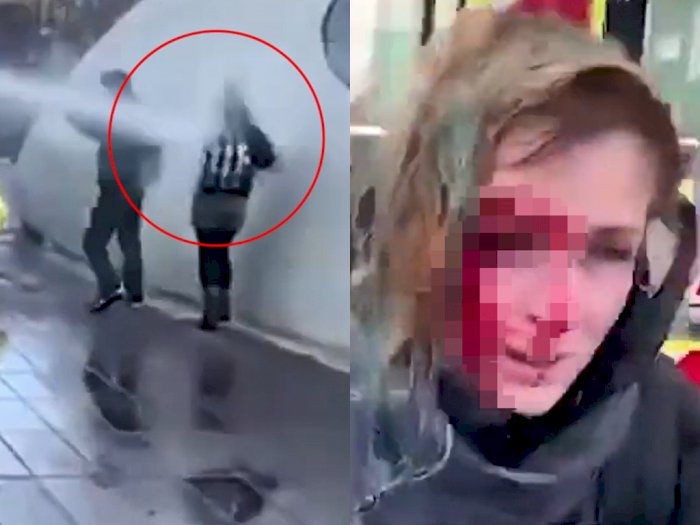 Rekam Video saat Kerusuhan, Wanita Ini Ditembak Meriam Air Polisi hingga Berlumuran Darah