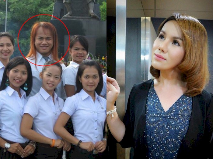 Transgender Thailand Ini Operasi Plastik Jadi Cantik, Bikin Pemuda Tajir Jatuh Cinta