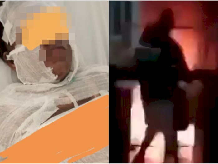 Video Detik-detik Rani Anggraini Dibakar Suami yang Selingkuh dengan Perempuan Lain