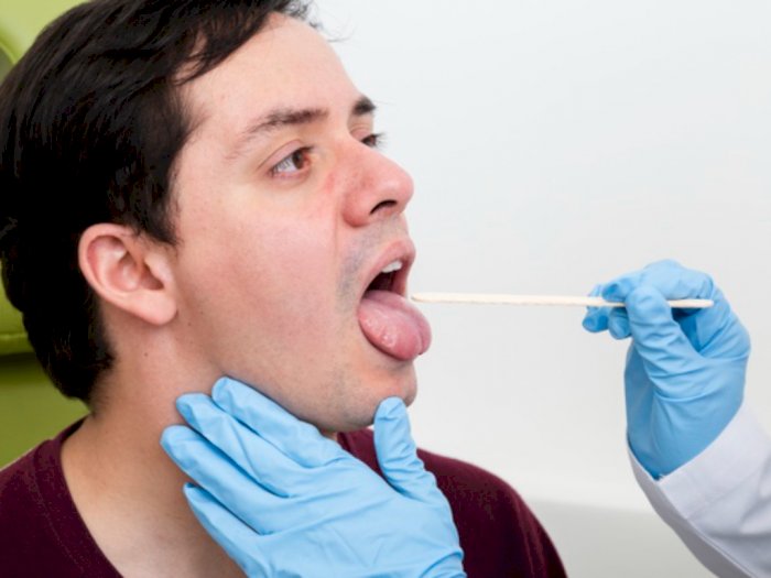 Mengenal Covid Tongue, Gejala Baru Virus Corona yang Mirip Sariawan