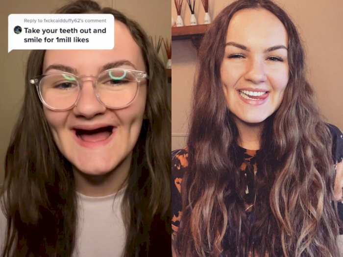 Wanita Ini Jadi Pecandu Narkoba hingga Kehilangan Gigi, Tetap Tersenyum & Bagikan Kisahnya