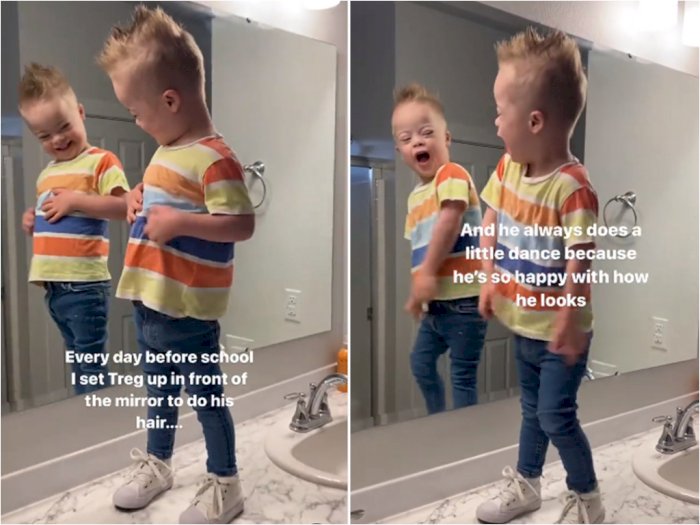 Gemas! Bocah Down Syndrome ini Selalu Menari di Depan Cermin Sebelum Berangkat Ke Sekolah 