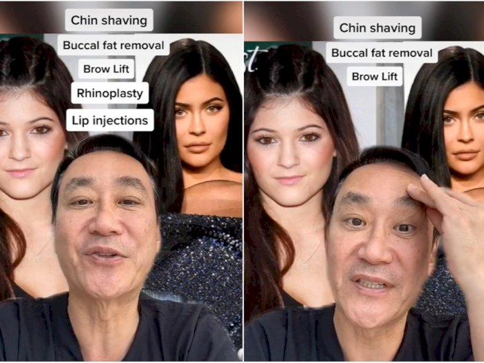 Ngaku Tidak Pernah Oplas, Dokter Bedah Ini Sebut Kylie Jenner