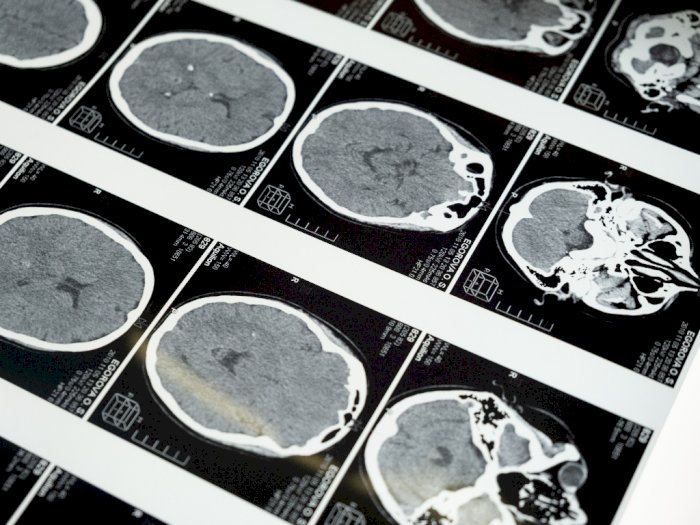 Tim Peneliti Ini Menemukan Musim Dapat Pengaruhi Fungsi Otak!