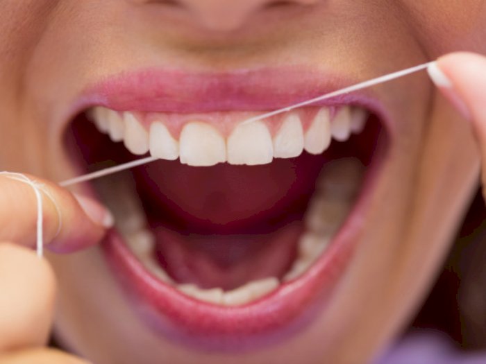 Cara Menghilangkan Karang Gigi Secara Alami Tanpa Perlu ke Dokter Gigi