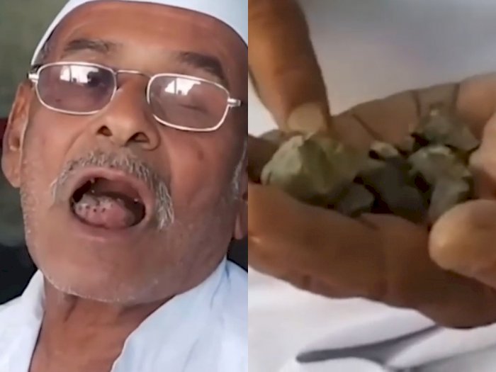 Aneh Tapi Nyata, Pria 78 Tahun Ini Selalu Makan Batu Selama 32 Tahun Agar Bertahan Hidup