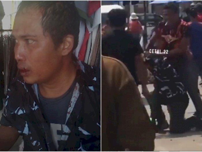 Ngeri, Anggota OKP Babak Belur Dikeroyok Anggota OKP Lain di Medan, Kepalanya Berdarah