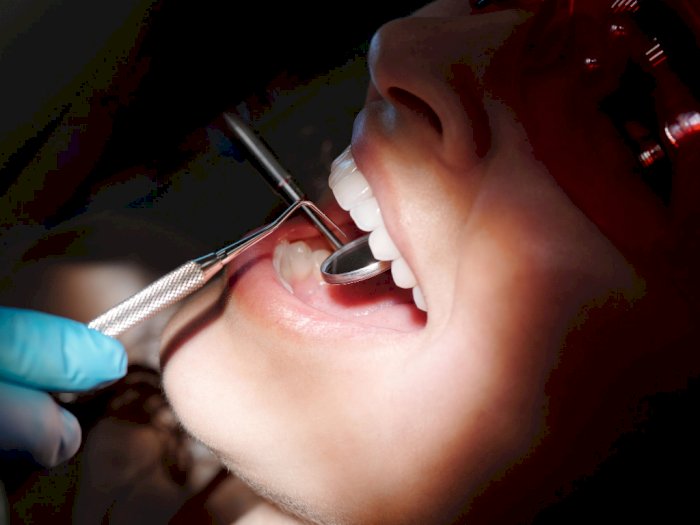 Kebiasaan Ngemil di Masa Pandemi Sebabkan 3 Masalah Kesehatan Gigi