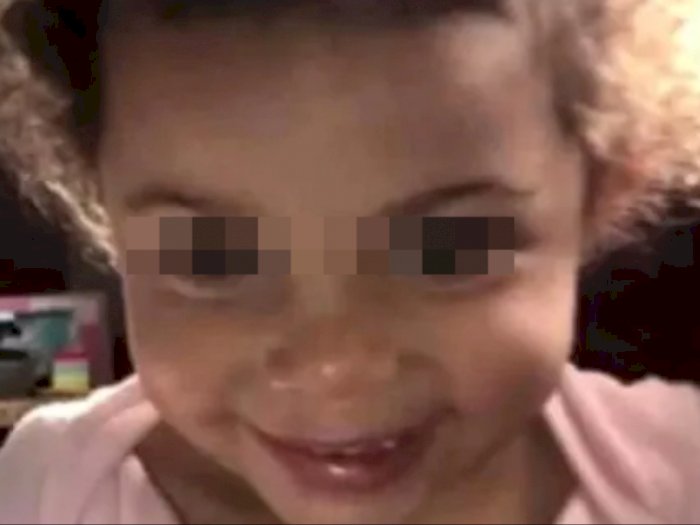 Kaki Gadis 2 Tahun Ini Harus Diamputasi Setelah Dapat Pelecehan dari Ayahnya Sendiri